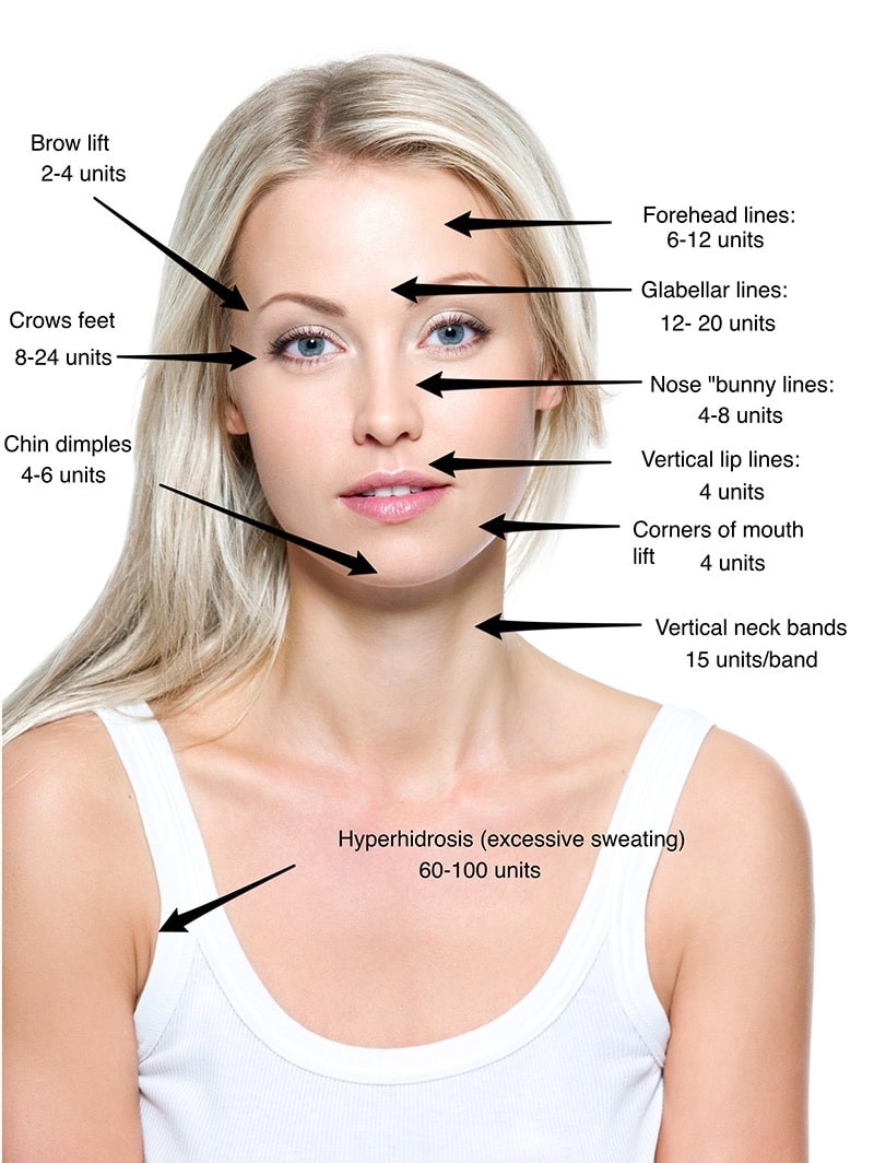 botox-injection-110