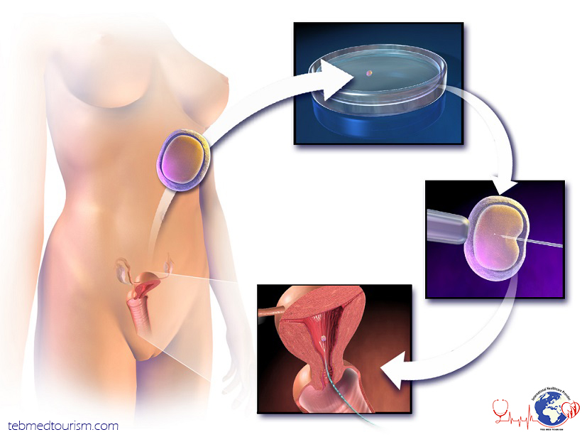 what-is-ivf-1-2