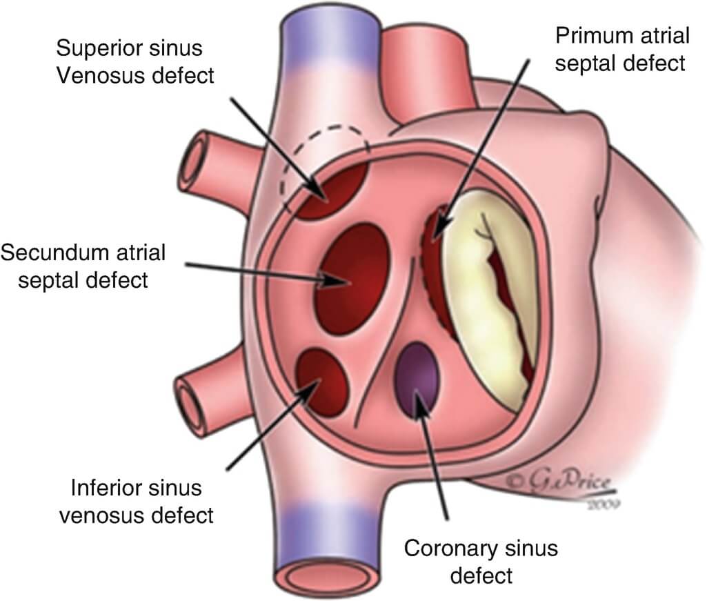 416961_1_en_18_fig1_html23-2