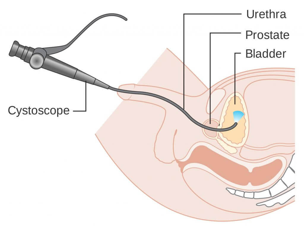 diagram-e1525467113843-1024x761-2