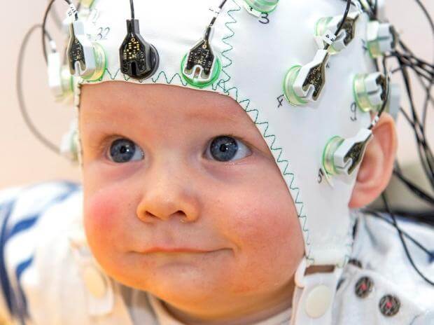 نوار مغز EEG