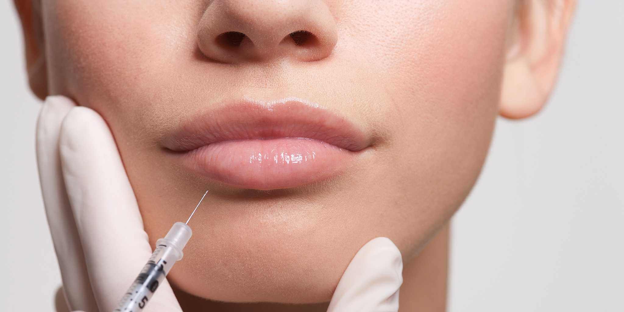 lip-filler