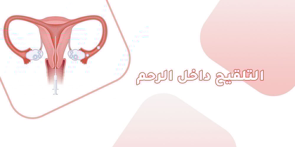 iui