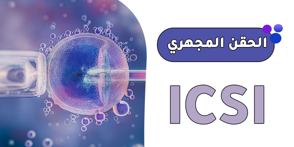 الحقن-المجهري