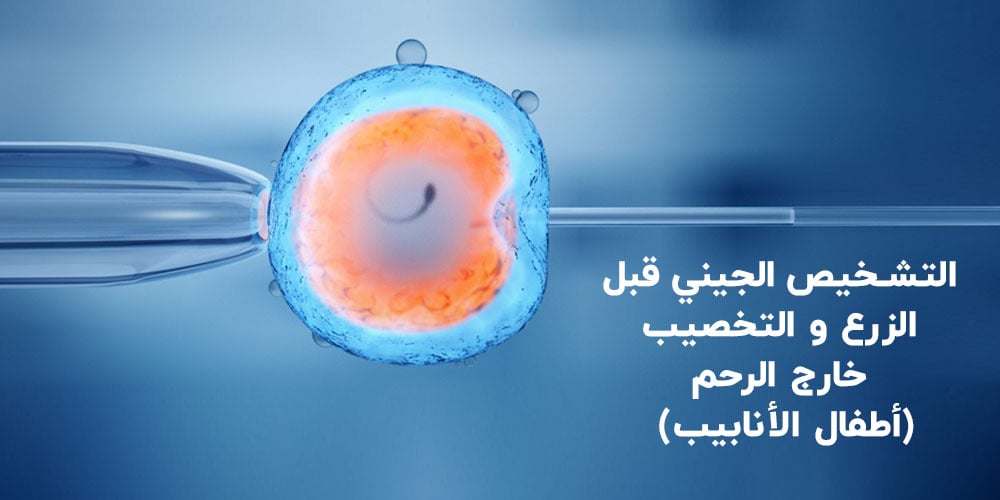 التشخيص-الجيني-و-أطفال-الأنابيب