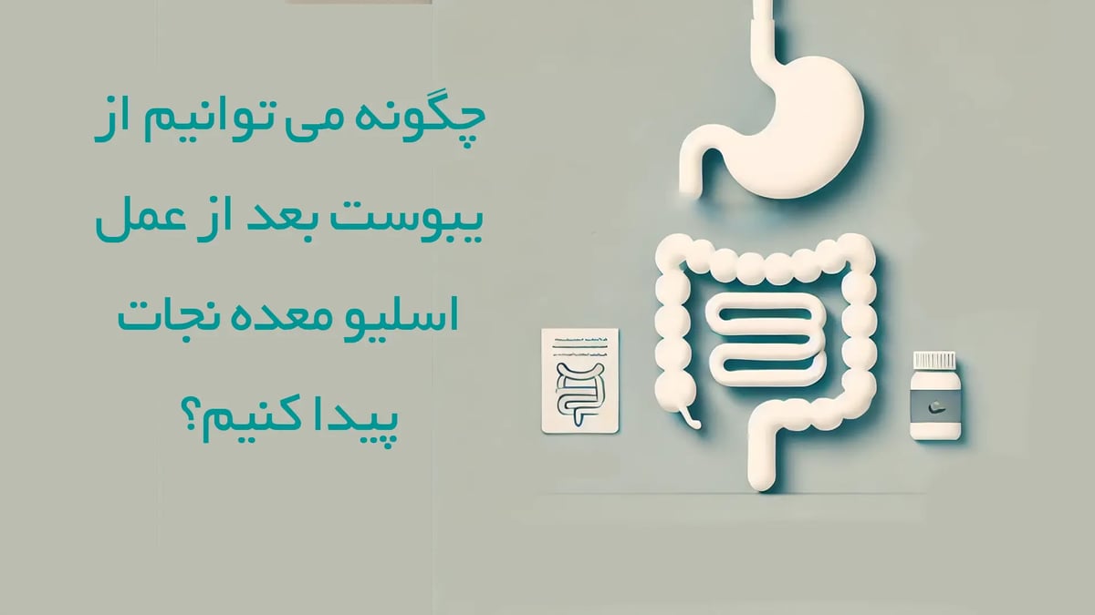 پیشگیری-از-یبوست-بعد-از-عمل-اسلیو-معده