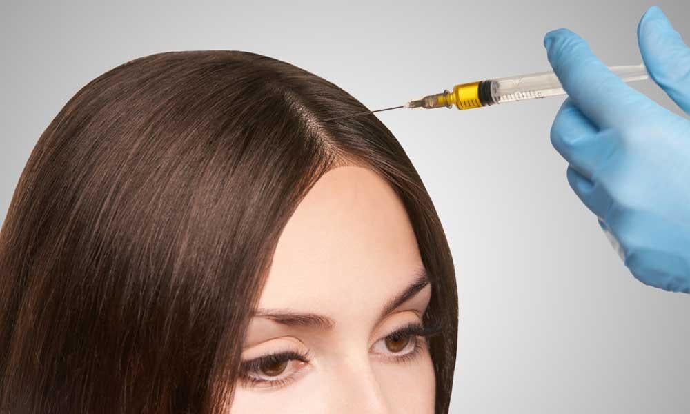 prp-injection