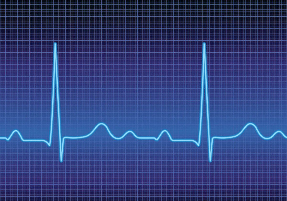 heart-arrhythmia-heart-rhythm-problems