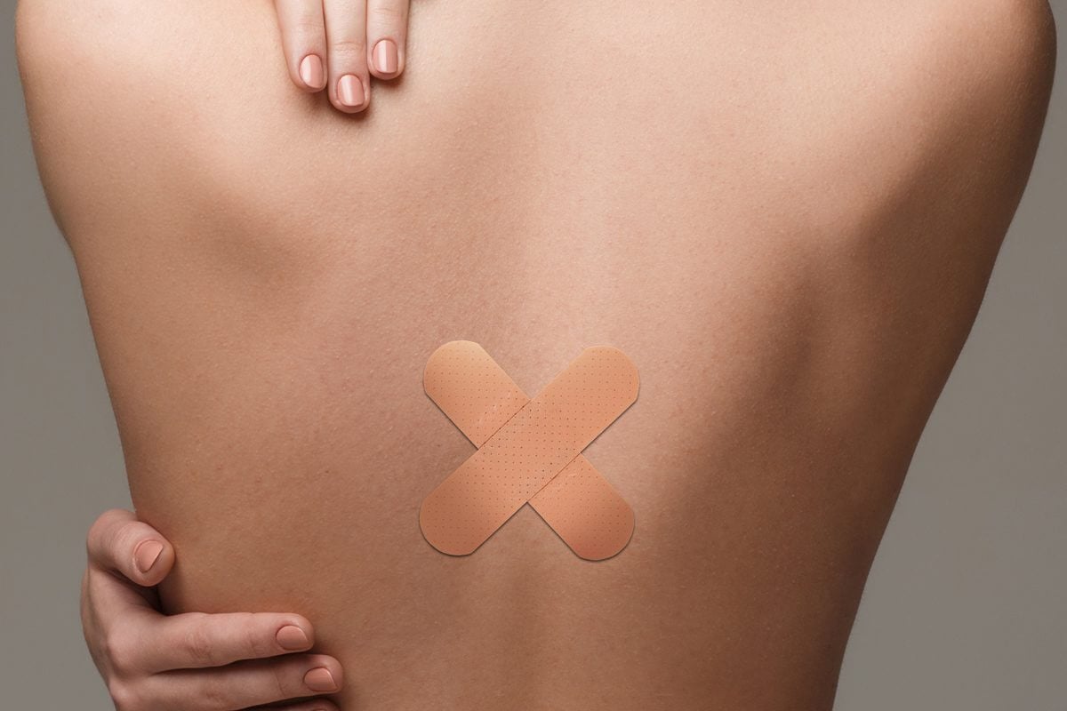 discectomy-in-iran