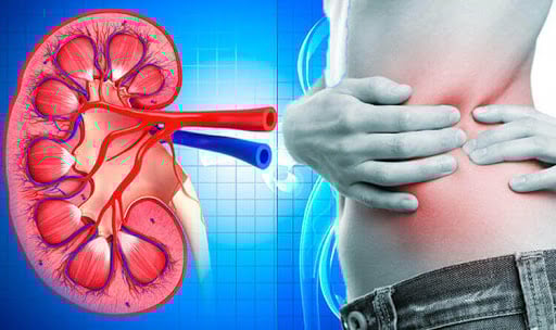 what-are-the-common-signs-of-kidney-cancer