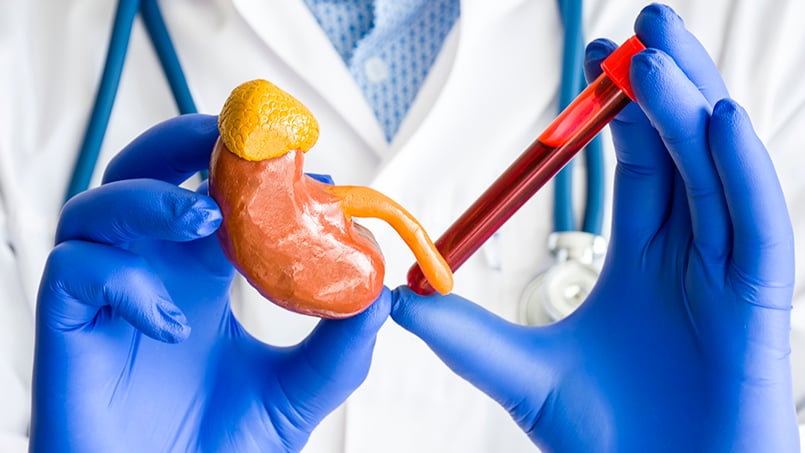 kidney-transplant-patients-and-covid-19