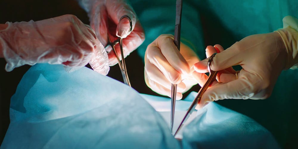 do-kidney-transplant-patients-need-special-cares