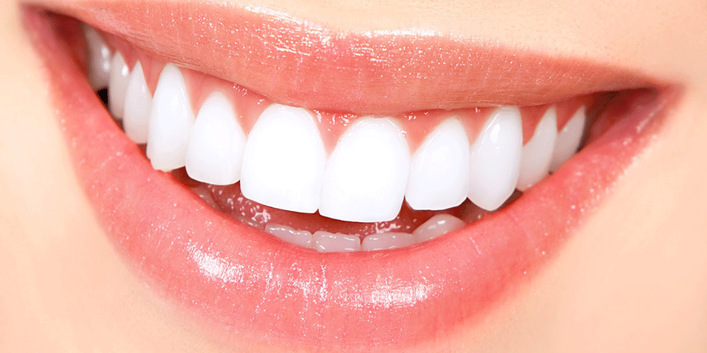 is-composite-dental-filling-in-hollywood-smile-essential