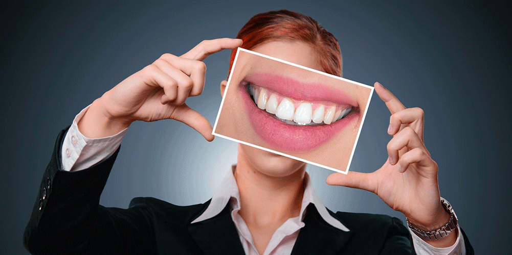 how-is-hollywood-smile-aftercare