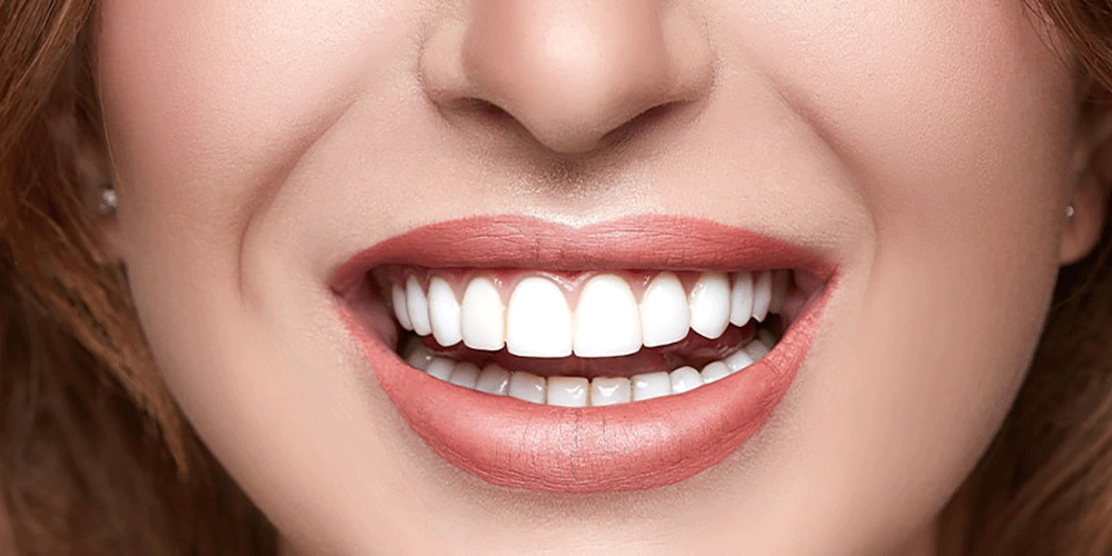 what-is-3d-hollywood-smile