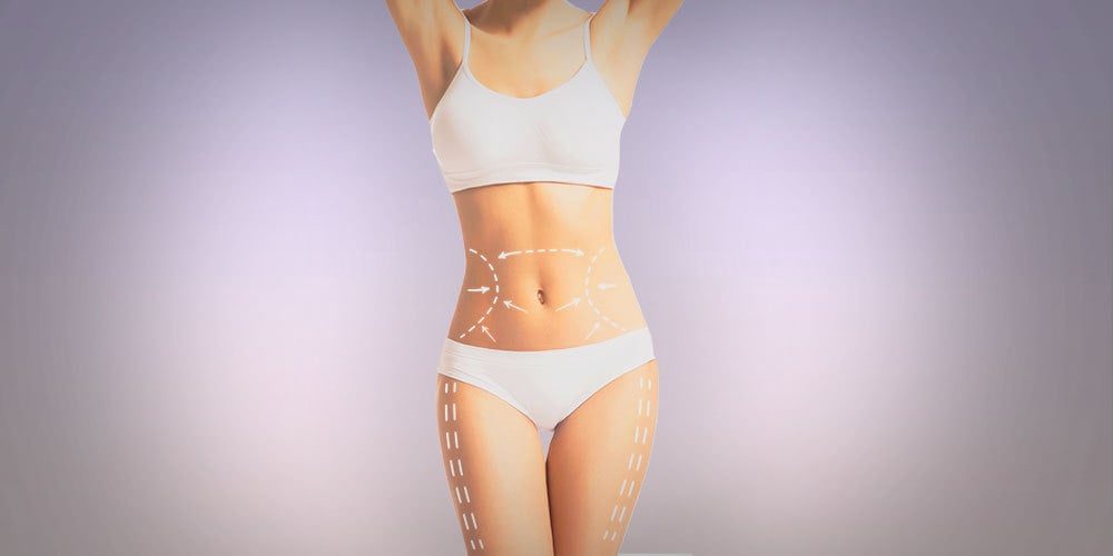 how-is-liposuction-done-on-the-stomach