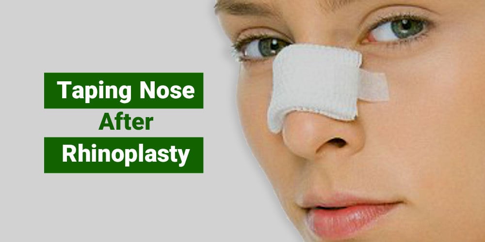 taping-nose-after-rhinoplasty