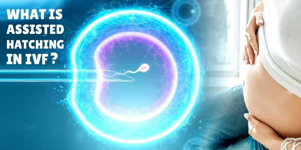what-is-assisted-hatching-in-ivf