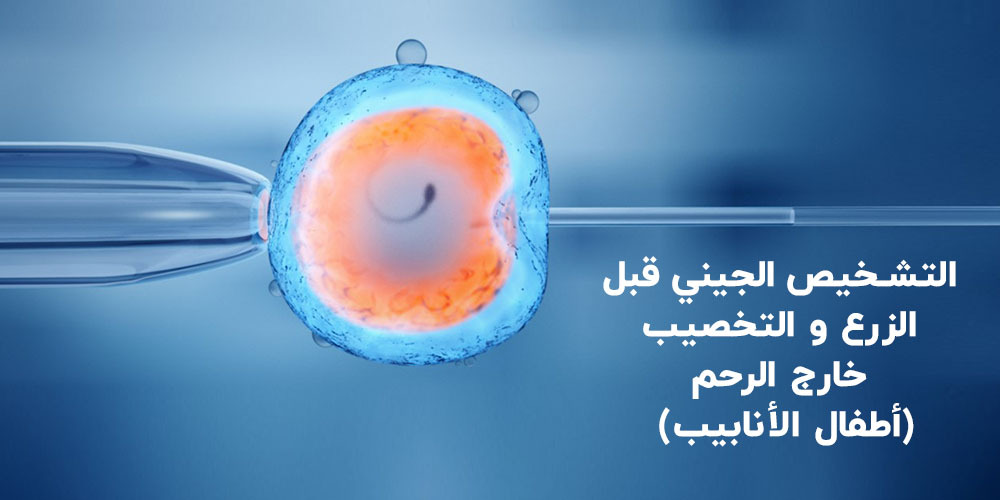 التشخيص الجيني قبل الزرع PGD و التخصيب خارج الرحم (أطفال الأنابيب) IVF