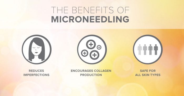 Microneedling