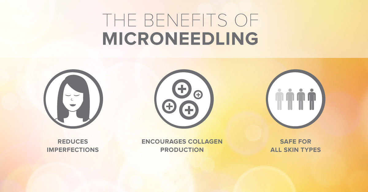 0247_microneedling_benefits_1200x627_fb