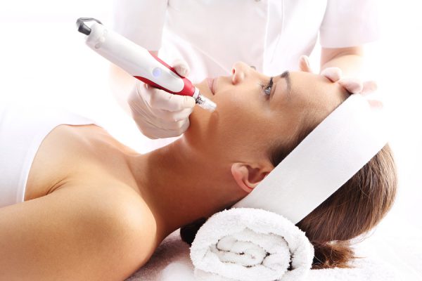 Microneedling