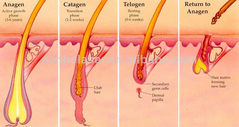 Hair Removal Laser