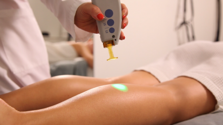 Hair Removal Laser