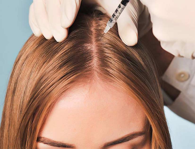 Hair Mesotherapy