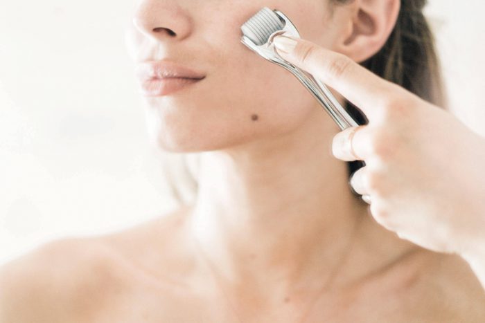 Microneedling