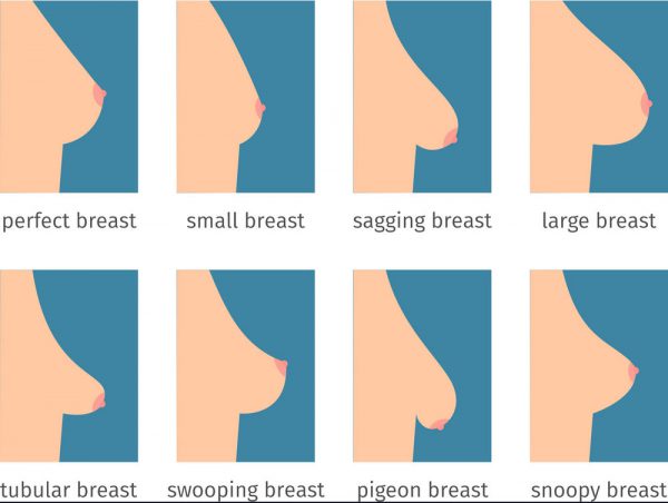 Breast Lift Mastopexy