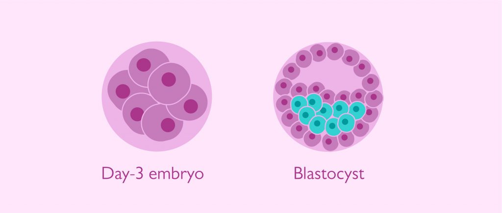 Blastocyst-ET cycle in Iran | complete cycle IVF in Iran | IVF Cost