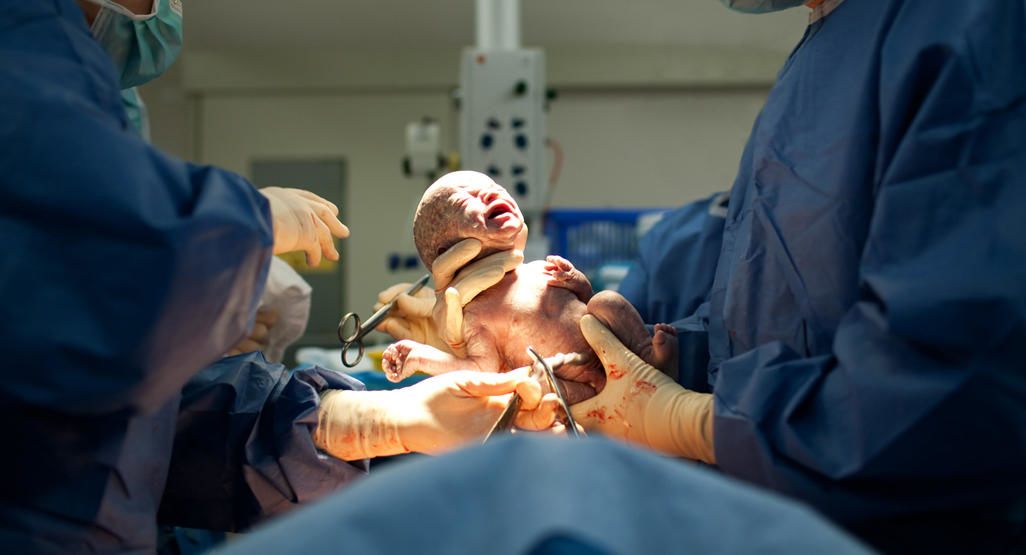 cesarean-section-2