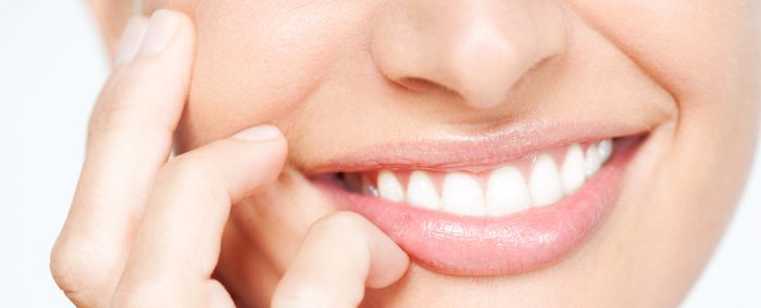 Tooth whitening or Bleaching