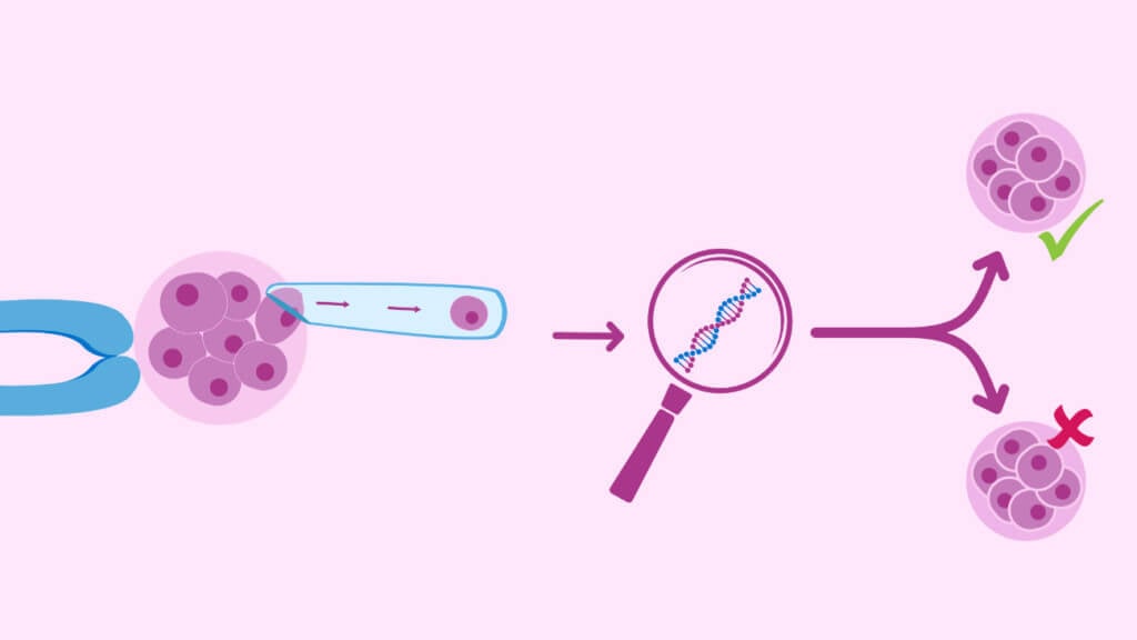 Egg Donation pgd