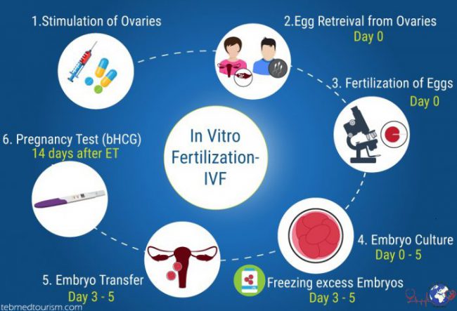 ivf in iran