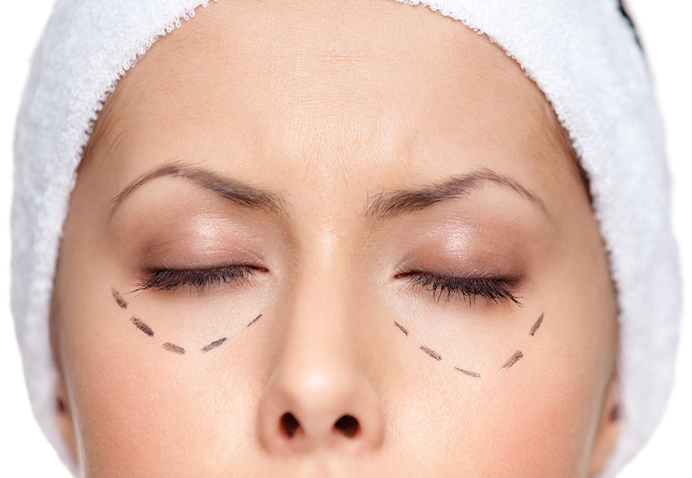 plasma-non-surgical-eye-lift-blepharoplasty