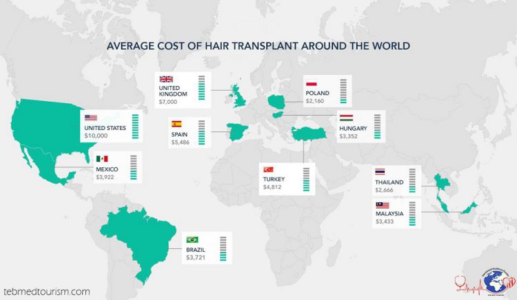 hair transplant cost in Iran e1598167940256
