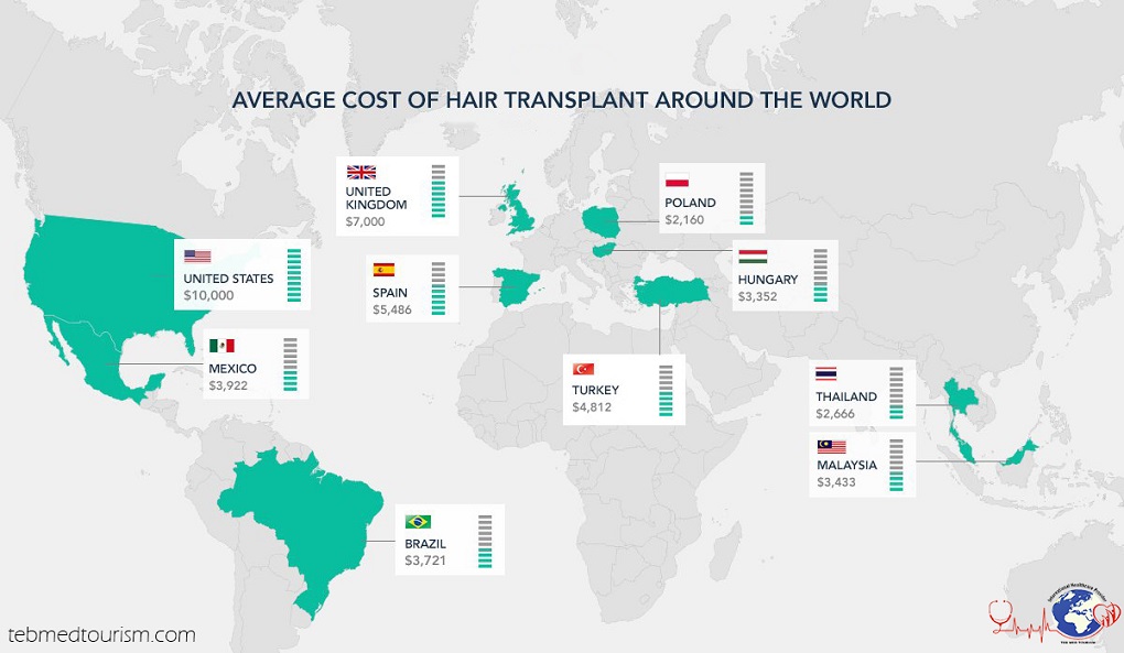 hair-transplant-cost-in-iran-3