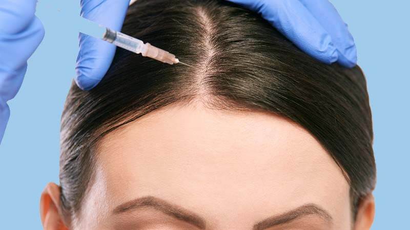 Hair Mesotherapy in Iran