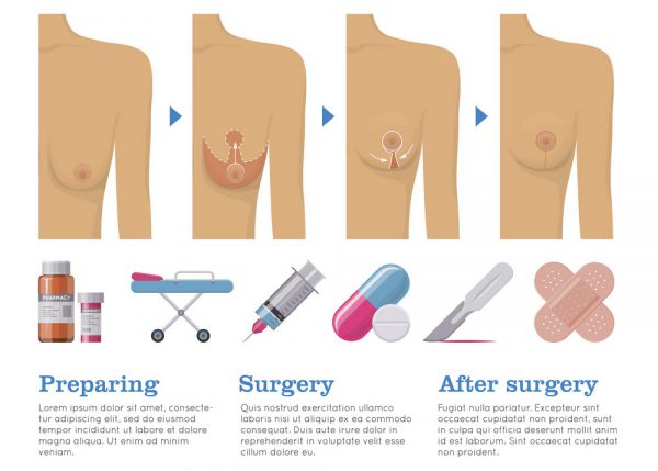 Breast Lift Mastopexy