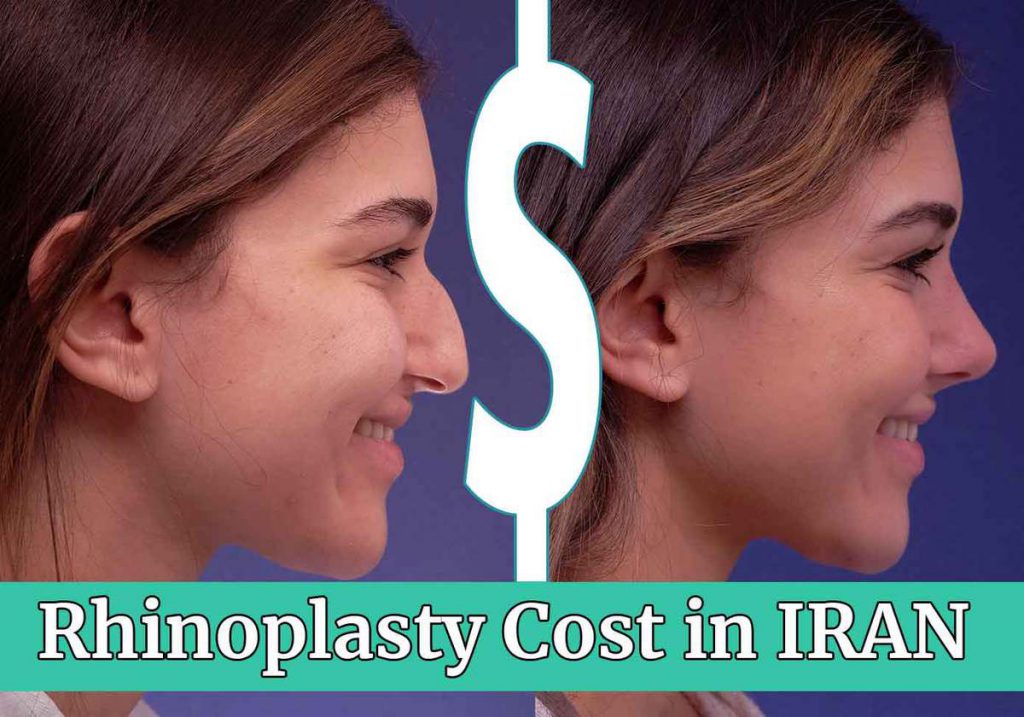 rhinoplasty cost in iran