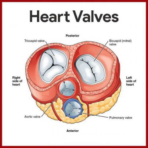 heart surgery