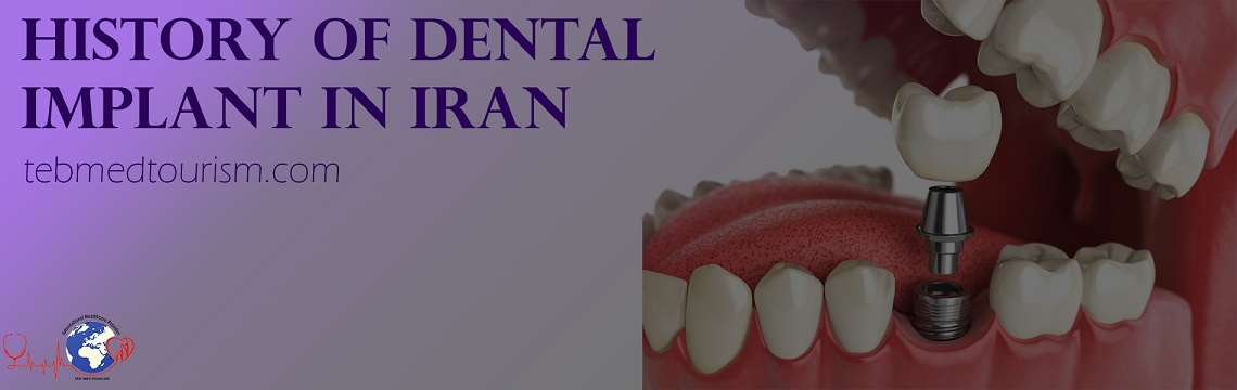 history-of-dental-implant-in-iran