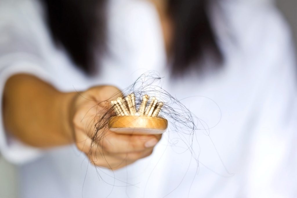 risks-of-hair-transplants