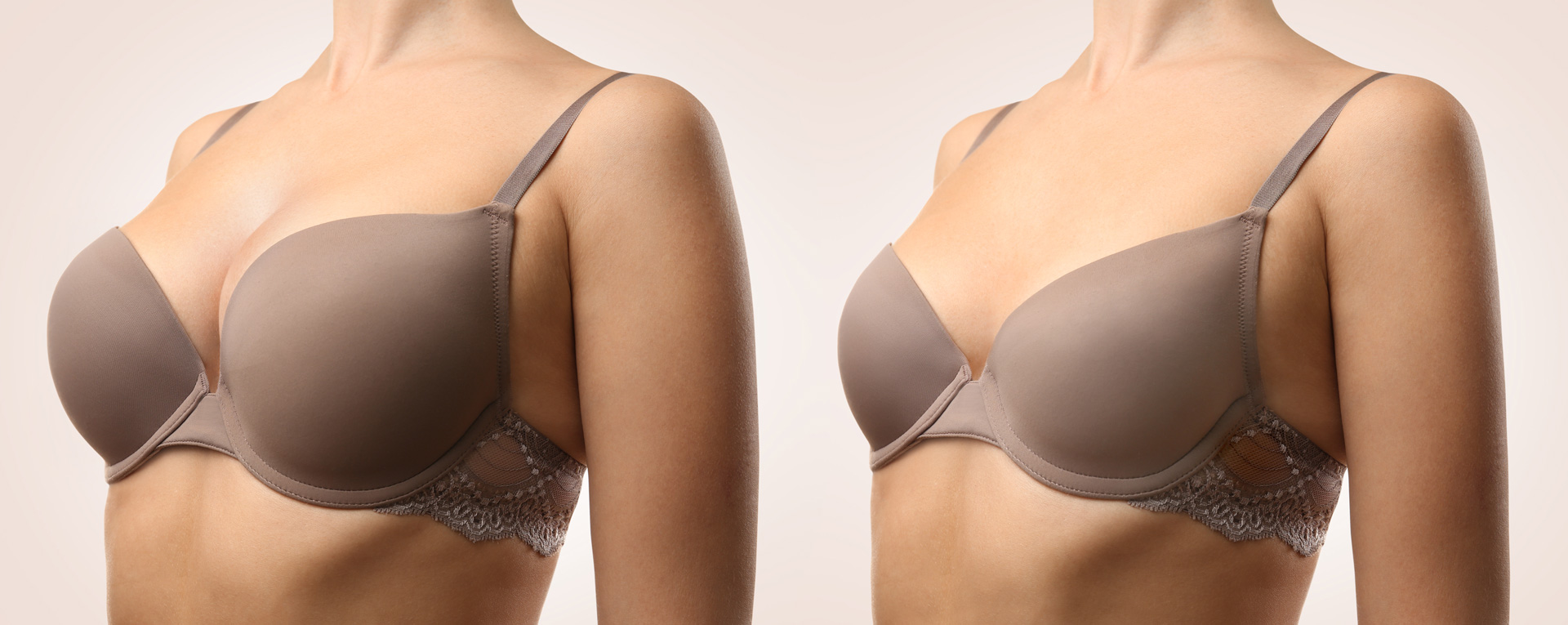 breast-reduction-header