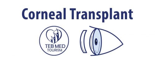 Corneal Transplant