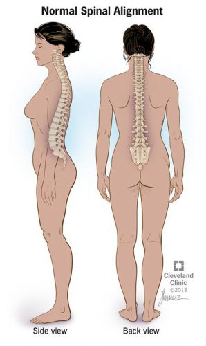 Spinal stenosis