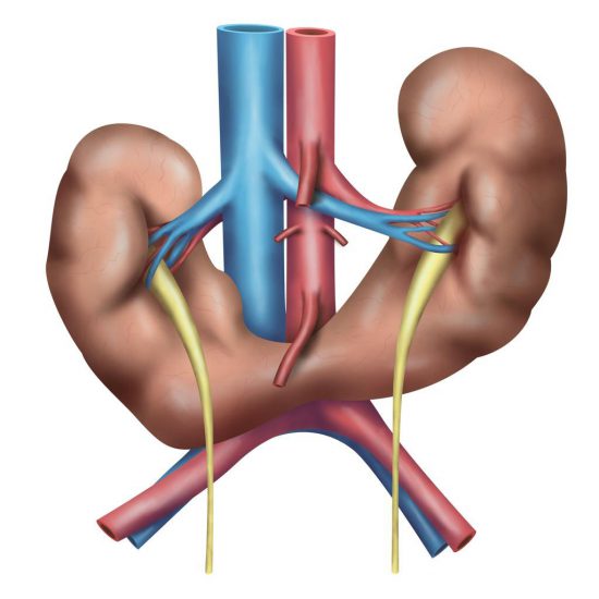 Kidney Transplant