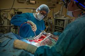 Open heart surgery (CABG)